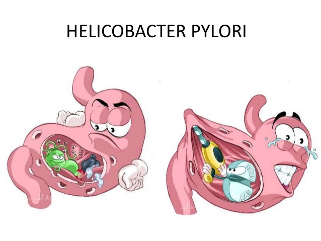 Helicobacter-pylori-1-638